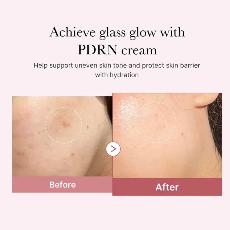 MEDICUBE PDRN PINK HYALURONIC MOISTURIZING CREAM 50ML