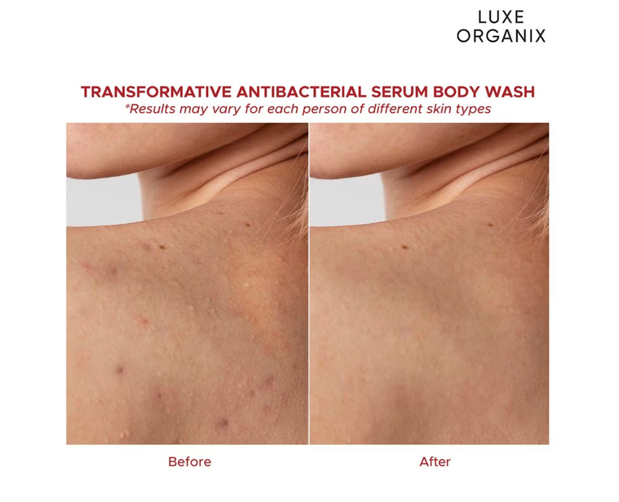 Luxe Organix Dermapro Salicylic Acid 2% Acne Rescue Serum Antibacterial Body Wash 500Ml