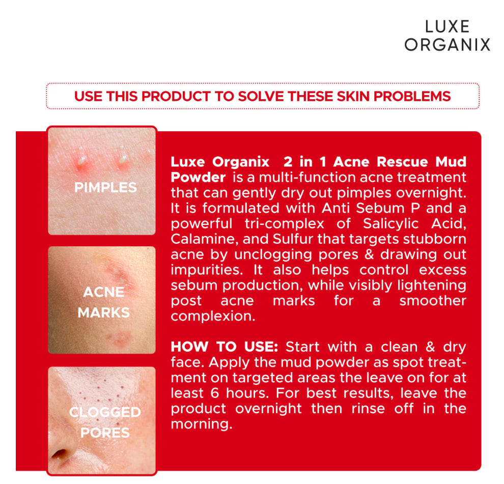 LUXE ORGANIX 2 in 1 Acne Rescue Mud Powder Overnight Pimple Drying 9g