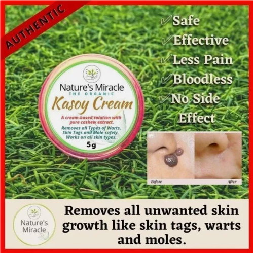 Nature’s Miracle Kasoy Cream 5g