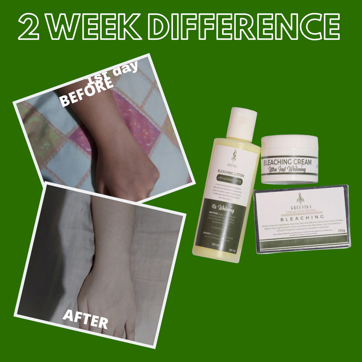 Greenika 3-in-1 Bleaching Set