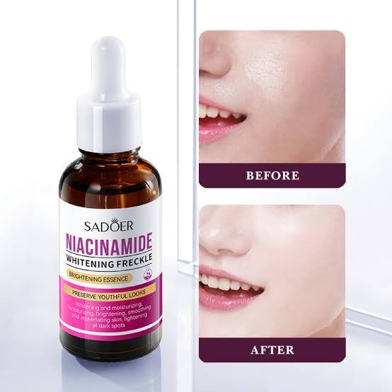 Sadoer Niacinamide Serum Whitening Anti-Freckle Serum 30ml