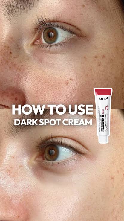 Medipeel Melanon X Cream 30ml