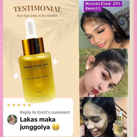 Minoxified 20% - Ultimate Hair Growth Formula: Extra Strength Minoxidil Solution
