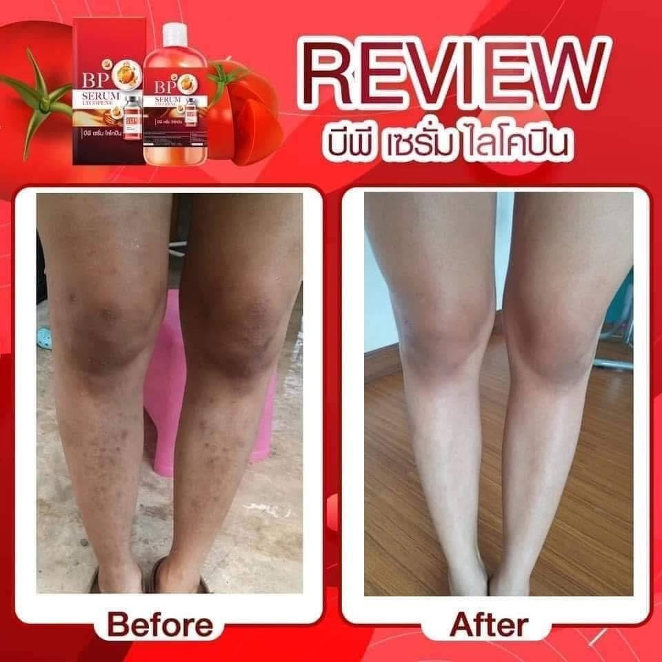 BP SERUM LYCOPENE 500ml