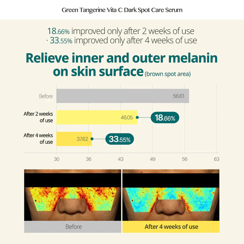 GOODAL Green Tangerine Vita C Dark Spot Care Serum 30ml + Dark Spot Care Cream 40ml