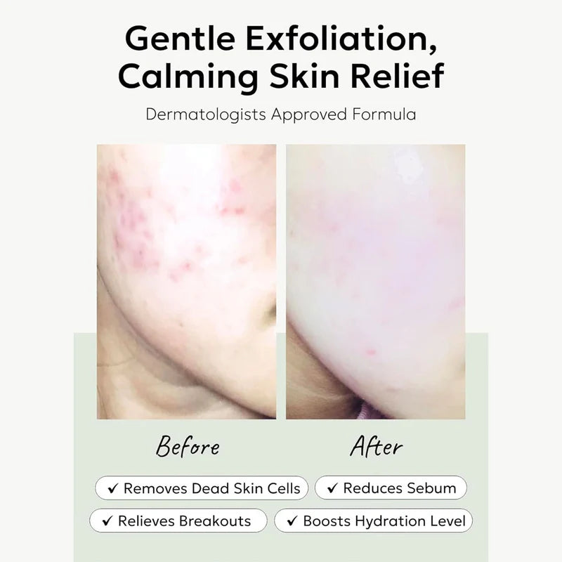 CELIMAX JI WOO GAE HEARTLEAF BHA PEELING PAD 60 Pads