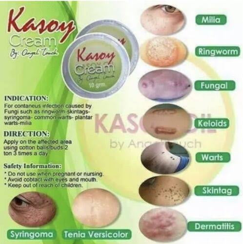 KASOY CREAM BY ANGEL TOUCH 5g