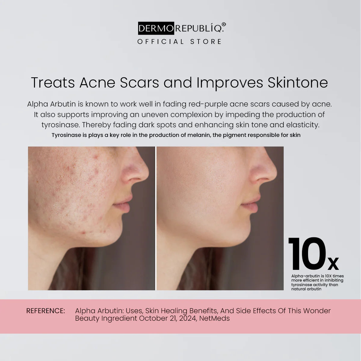 dermorepubliq 2% alpha arbutin + niacinamide + ha dark spot corrector serum - 30 ml