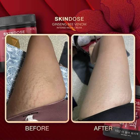 SkinDose Ginseng Bee Venom Night Cream - Korean Anti-Aging Therapy 400g