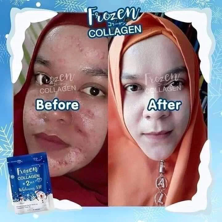 Frozen Collagen 2in1 x10 Whitening - 60 Capsules