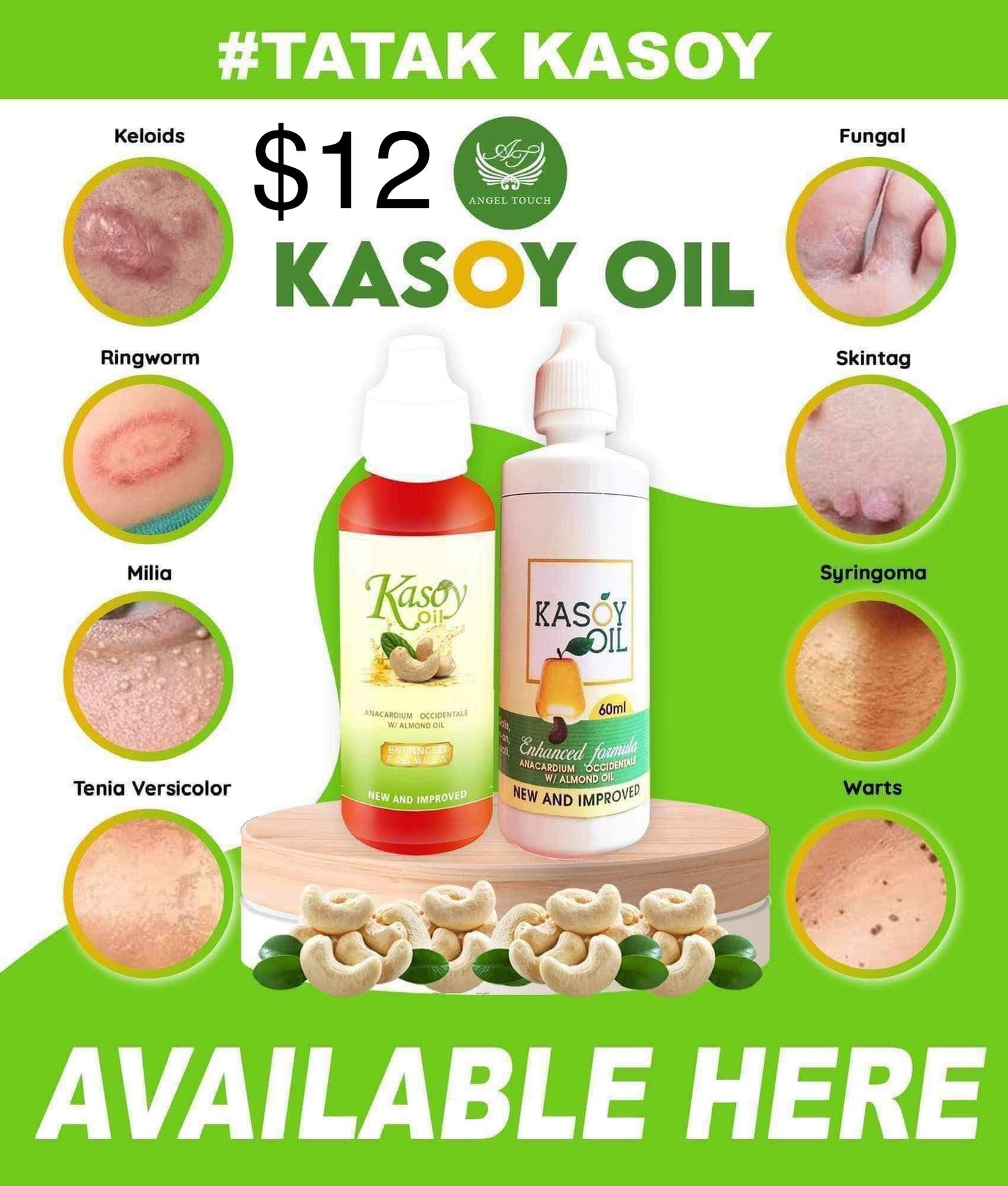 Kasoy Oil 60ml