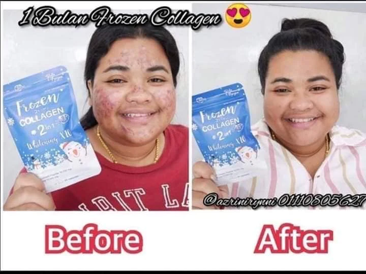 Frozen Collagen 2in1 x10 Whitening - 60 Capsules