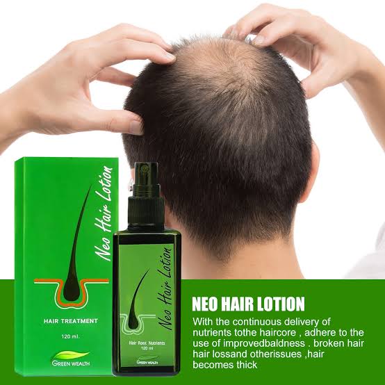 Neo Hair Lotion - Hair Loss Treatment by GreenWealth 120ml