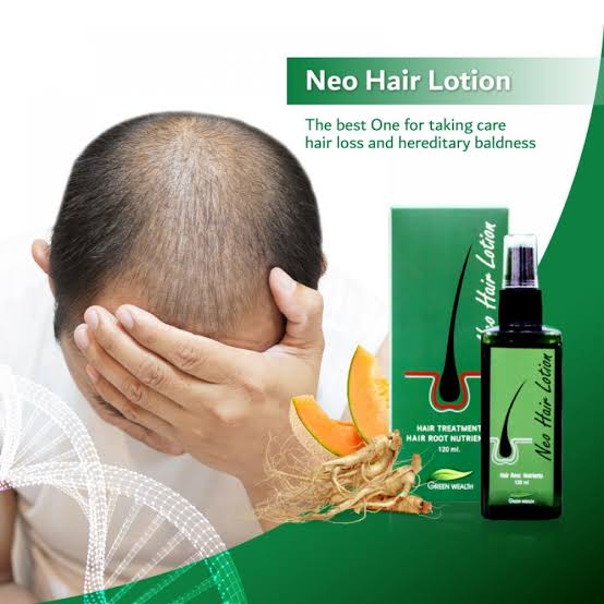 Neo Hair Lotion - Hair Loss Treatment by GreenWealth 120ml