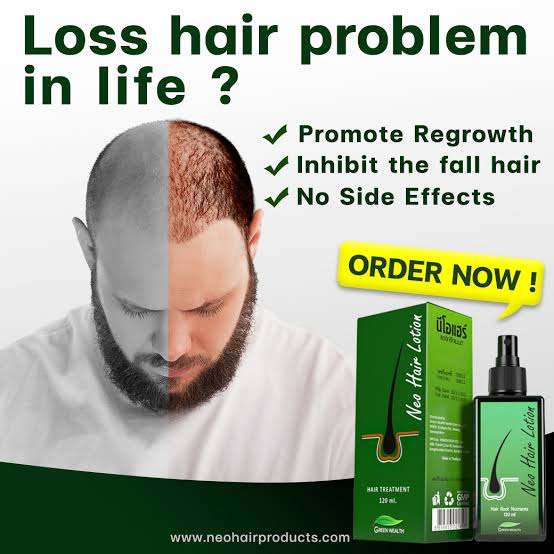 Neo Hair Lotion - Hair Loss Treatment by GreenWealth 120ml