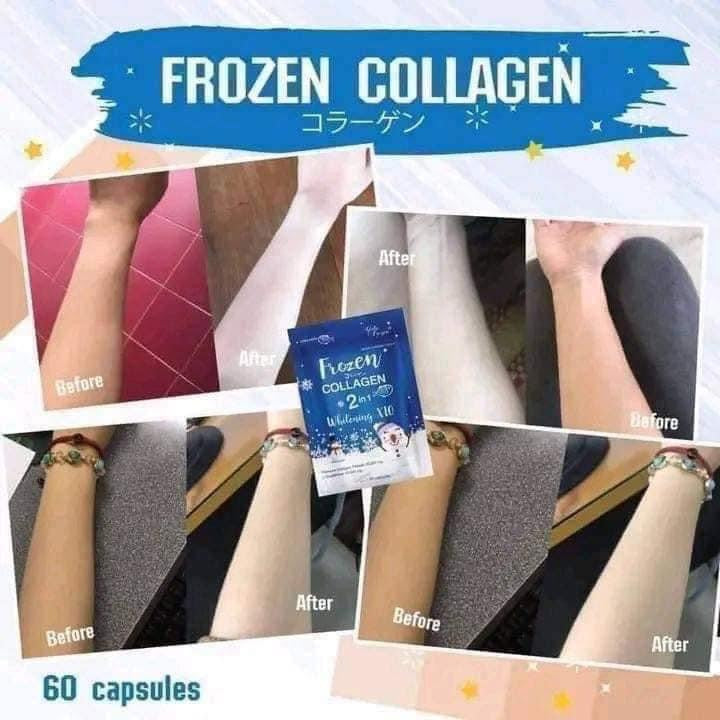 Frozen Collagen 2in1 x10 Whitening - 60 Capsules