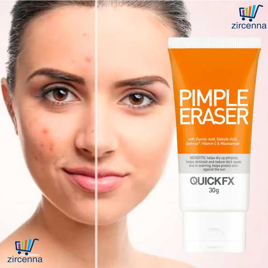 QuickFX Pimple Eraser Cream 30g