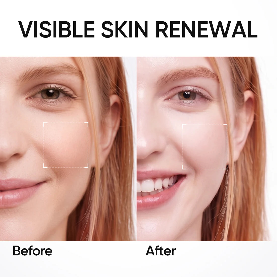 SKINTIFIC PDRN Bright & Smooth Serum 20ML (PDRN SODIUM DNA 5000 PPM)