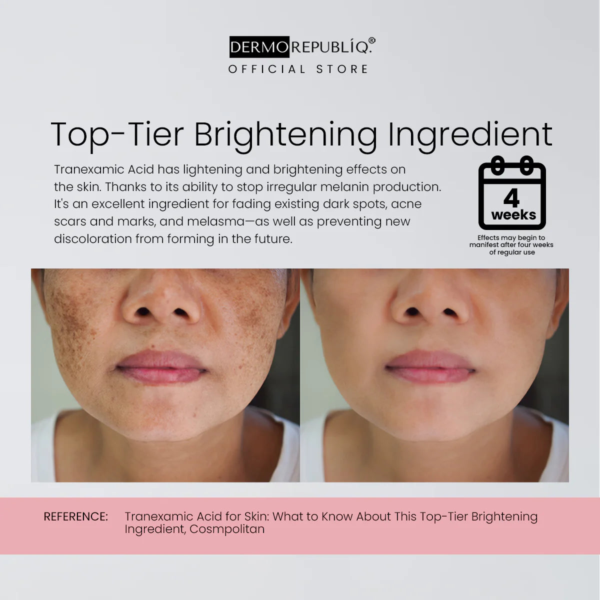 dermorepubliq 10% niacinamide + 3% tranexamic acid + 2% alpha arbutin ultra white serum - 30ml