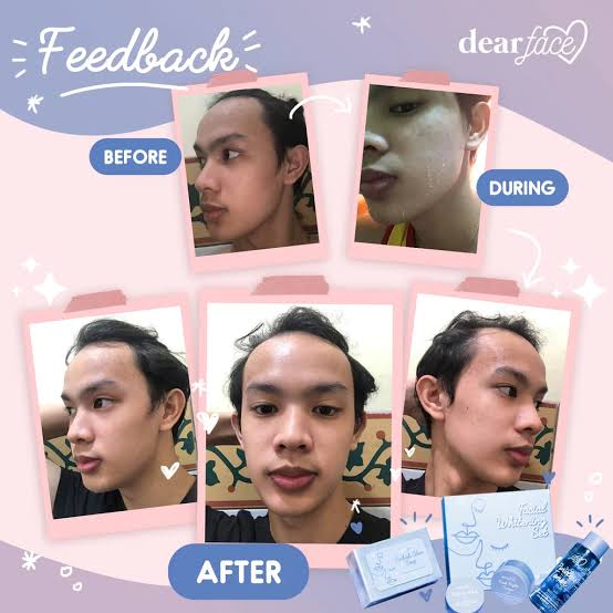 Dear Face Facial Whitening Set