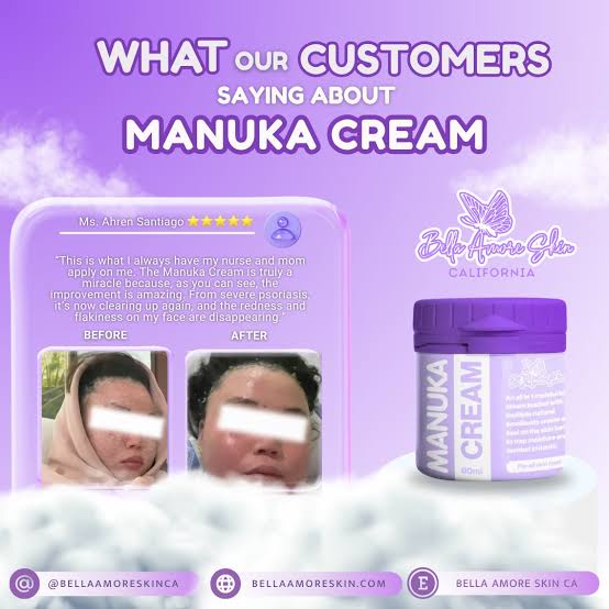 Bella Amore Skin Manuka Cream - 60ml