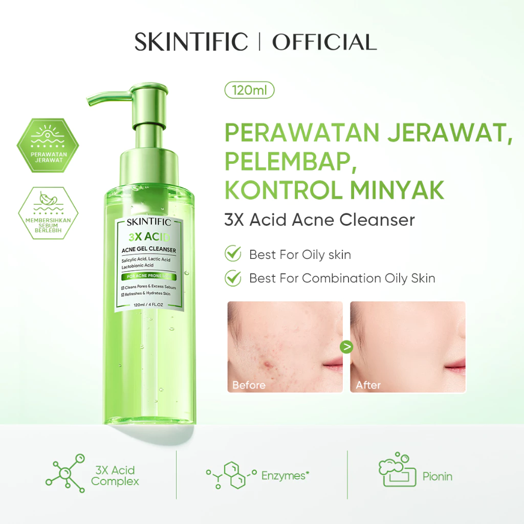 SKINTIFIC 3X Acid Acne Gel Cleanser 120ML