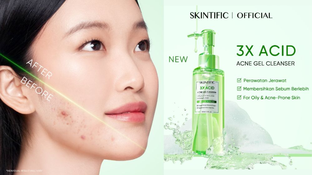 SKINTIFIC 3X Acid Acne Gel Cleanser 120ML