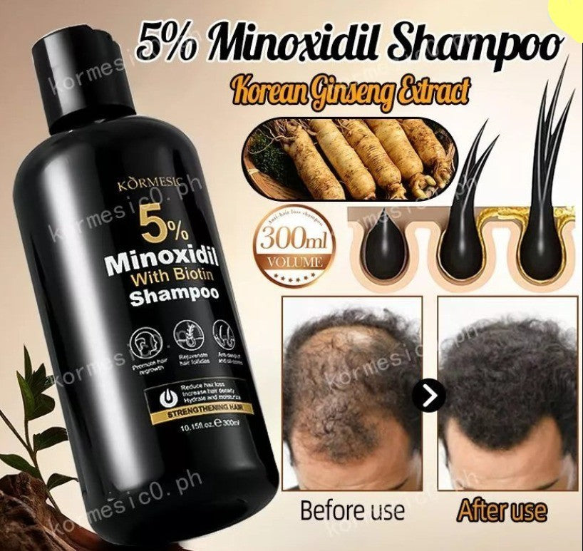 KORMESIC 5% Minoxidil With Biotin Shampoo for Hairloss 300ml