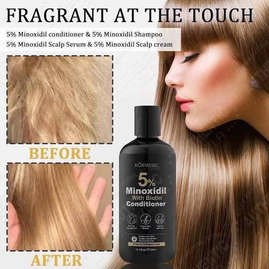 KORMESIC Minoxidil 5% Conditioner For Hair Loss 300ML
