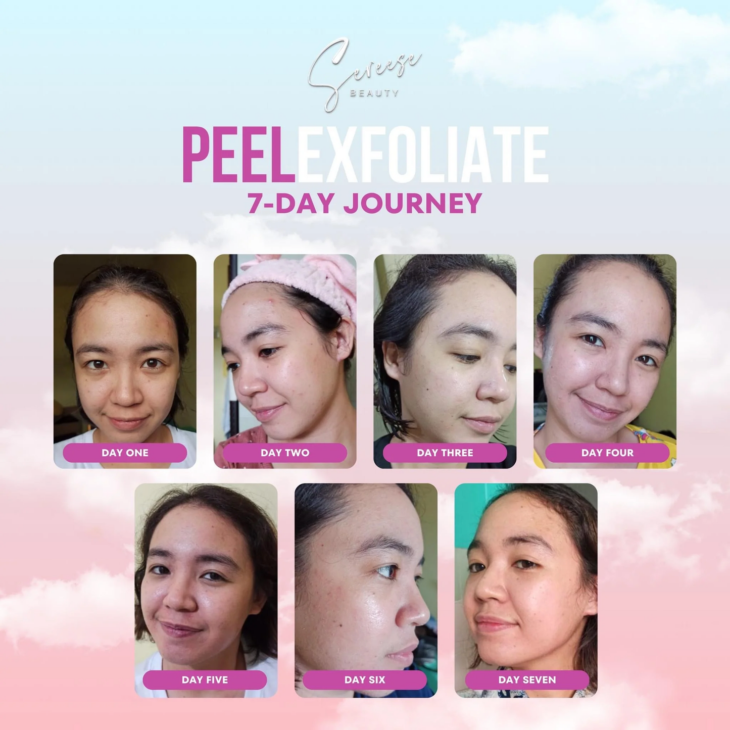 Sereese Beauty Peelexfoliate with Kakadu Set