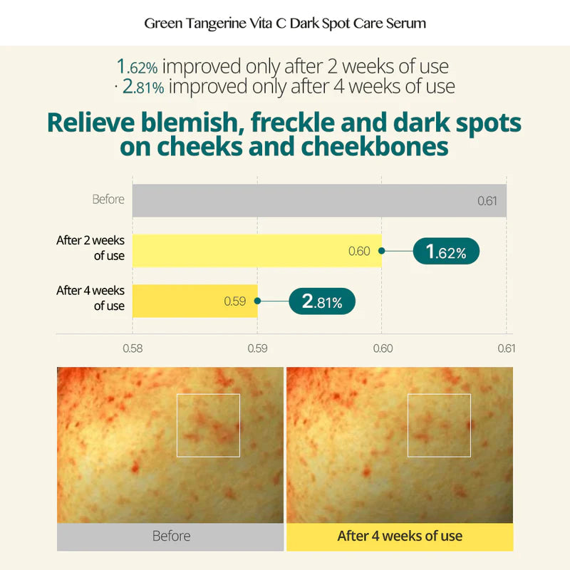GOODAL Green Tangerine Vita C Dark Spot Care Serum 30ml + Dark Spot Care Cream 40ml
