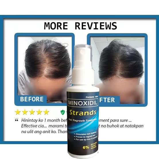 Minoxidil Strands 6% - 60ml Hairgrower