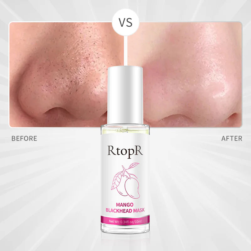 RtopR Mango Blackhead Mask Strong Pell Off Blackhead Remover Mask Nose Mask Deep Cleansing for Face & Nose