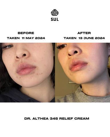 Dr. Althea 345 Relief Cream 50ml