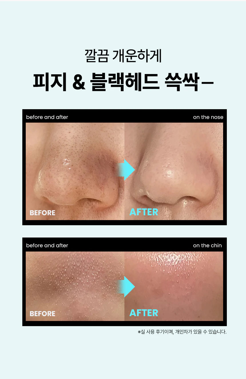 ilso Super Melting Sebum Softener 150ml Set (+Cotton Pad 40P)