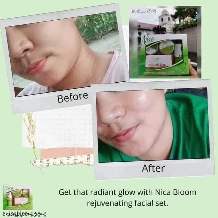 Nica Bloom Rejuvinating Set