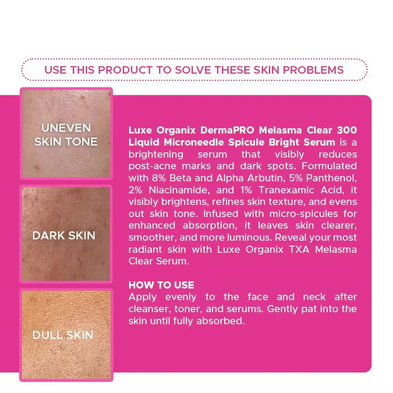 LUXE ORGANIX TXA MELASMA CLEAR 300 MICRONEEDLE SPICULE BRIGHT SERUM 30ML